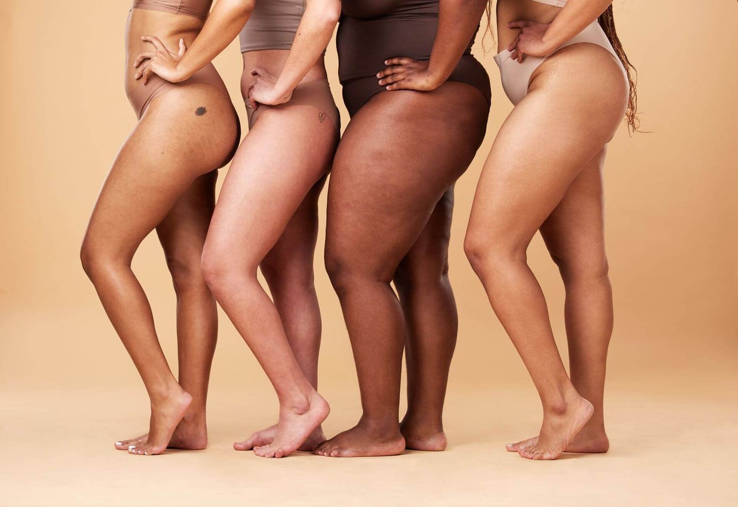 Cellulite